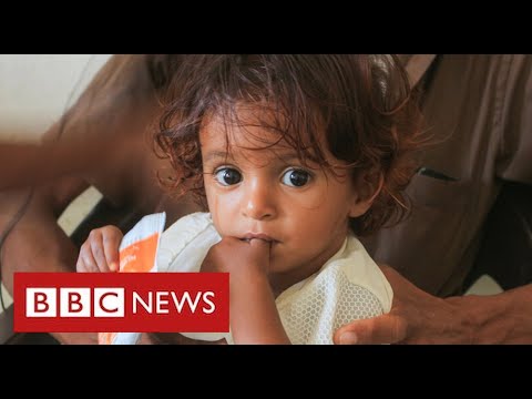 Yemen: a war with no military solution ... and perhaps no political solution either